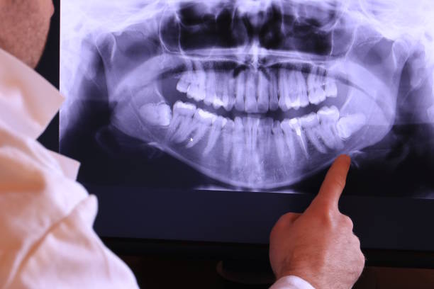 Best Walk-In Emergency Dentist in Tiburon, CA