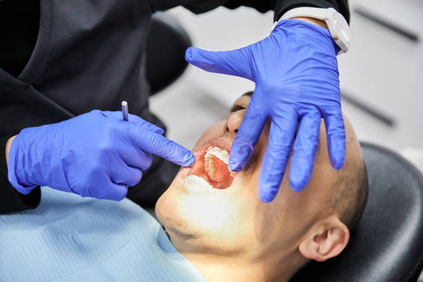 Best Emergency Dental Surgery in Tiburon, CA