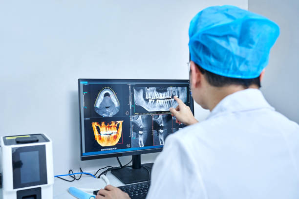 Best Emergency Root Canal Treatment in Tiburon, CA